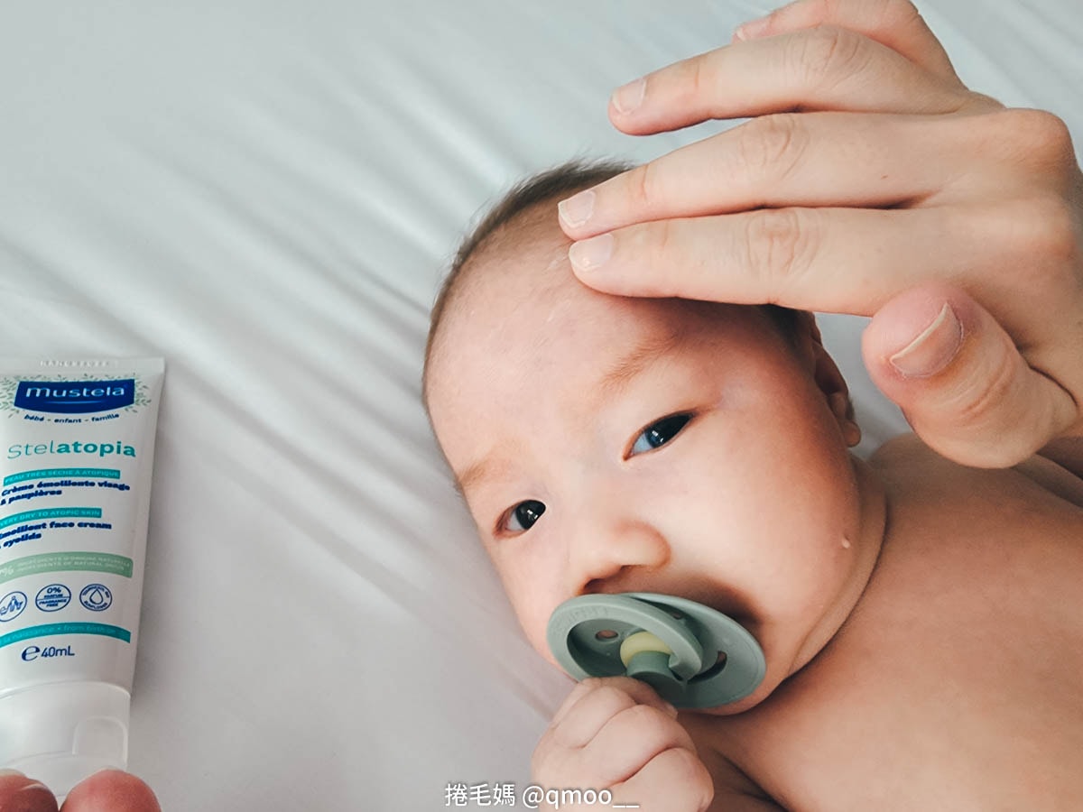 寶寶乳液推薦 慕之恬廊 專為異癢乾肌設計的無香精乳液 – 舒恬良系列 嫩嬰換季不再乾乾癢癢